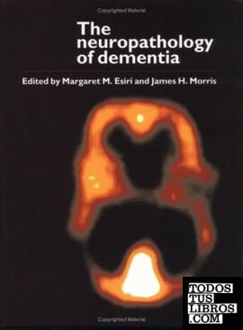 Neuropathology Of Dementia , The
