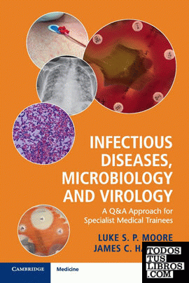 INFECTIOUS DISEASES, MICROBIOLOGY AND VIROLOGY