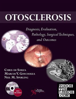 Otosclerosis diagnosis evaluation pathology surgical techniques and outcomes