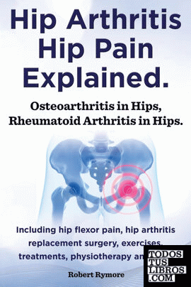 Hip Arthritis, Hip Pain Explained. Osteoarthritis in Hips, Rheumatoid Arthritis in Hips. Including Hip Arthritis Surgery, Hip Flexor Pain, Exercises,