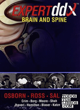 Expert Differential Diagnoses: Brain And Spine