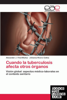 Cuando la tuberculosis afecta otros órganos