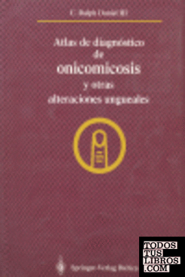 Atlas de diagnóstico de onicomicosis y otras alteraciones ungueales