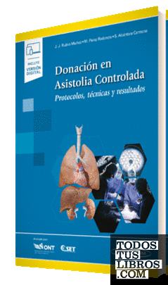 Donación en Asistolia Controlada