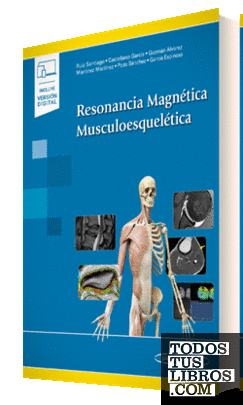 Resonancia Magnética Musculoesquelética