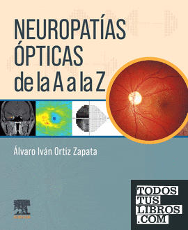 Neuropatías ópticas de la A a la Z