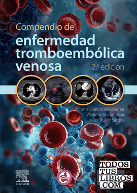 Compendio de enfermedad tromboembólica venosa, 2.ª edición