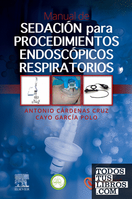 Manual de sedación para procedimientos endoscópicos respiratorios