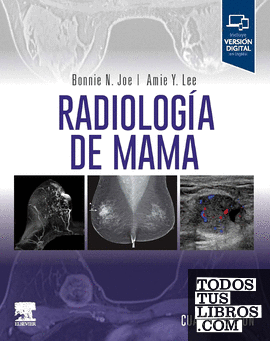 Radiología de mama, 4.ª Edición