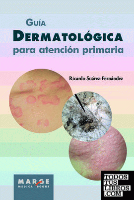 Guía dermatológica para atención primaria