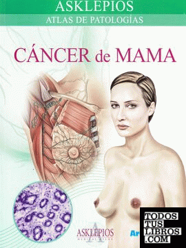 Atlas de cáncer de mama