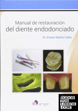 Manual de restauración del diente endodonciado
