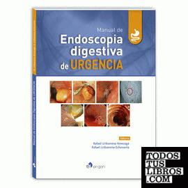 Manual de Endoscopia digestiva de Urgencia