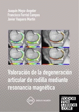 VALORACION DE LA DEGENERACION ARTICULAR DE RODILLA MEDIANTE RESONANCIA MAGNETICA