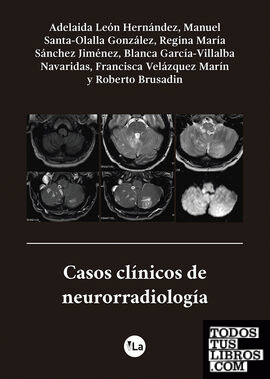 Casos clínicos de neurorradiología