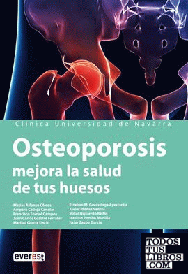 Osteoporosis. Mejora la salud de tus huesos