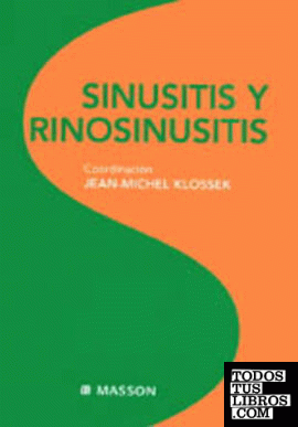 Sinusitis y Rinosinusitis