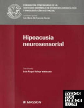 Hipoacusia neurosensorial