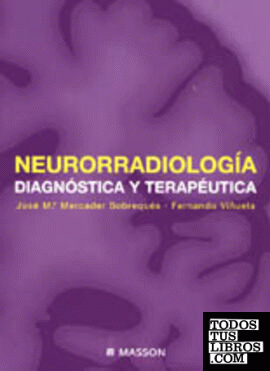 Neurorradiología diagnóstica y terapéutica