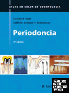 Atlas de periodoncia