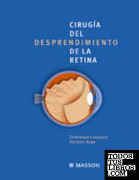 Cirugía del desprendimiento de la retina