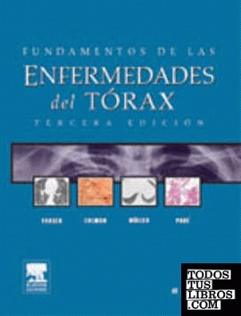 Fundamentos de las enfermedades del tórax