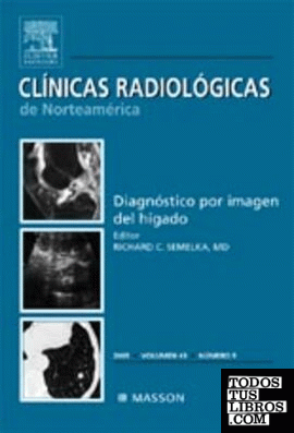 Clínicas Radiológicas de Norteamérica 2005, nº 5: Diagnóstico por imagen del hígado