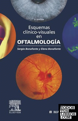 Esquemas clínico-visuales en oftalmología