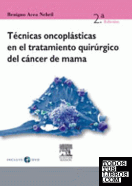 Técnicas oncoplásticas en el tratamiento quirúrgico del cáncer de mama