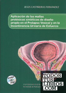 Aplicación de las mallas protésicas sintéticas de diseño propio en el Prolapso Vesical y en la incontinencia Urinaria de Esfuerzo