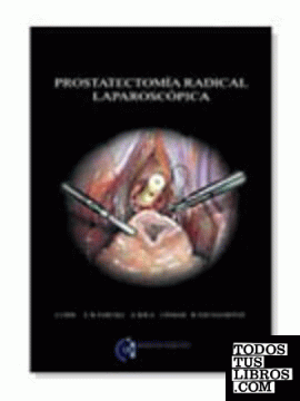 Prostatectomía radical laparoscópica