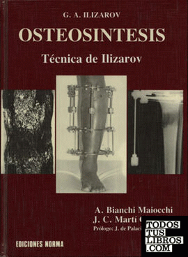 Osteosintesis