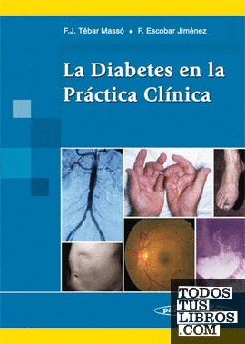 Diabetes Mellitus Clnica