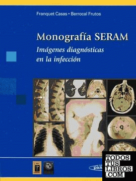 Monografía SERAM: Imágenes diagnósticas en la infección (Casas / Frutos)