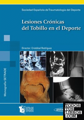 Lesiones Cronicas Tobillo Dep.