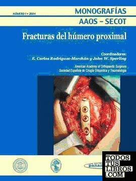 Monografía Nº 1/2004: Fracturas del Húmero Proximal