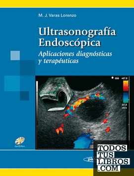 Ultrasonografa Endoscpica