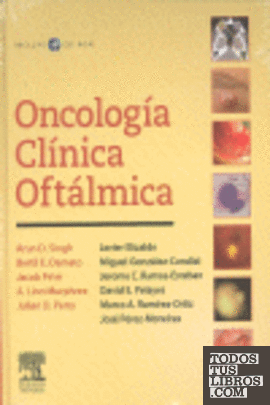 Oncología clínica oftálmica