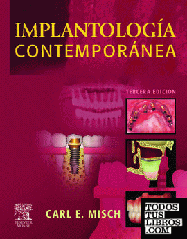 Implantología contemporánea