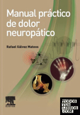Manual práctico de dolor neuropático