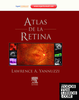 Atlas de la retina + ExpertConsult