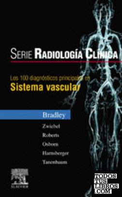 Los 100 diagnósticos principales en sistema vascular
