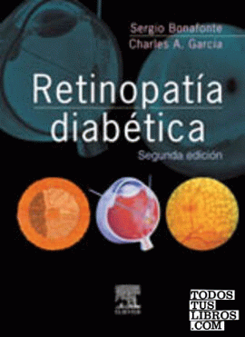 Retinopatía diabética