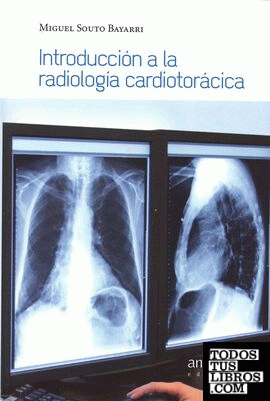 Introducción a la radiología torácica