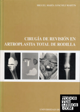 CIRUGÍA DE REVISIÓN EN ARTROPLASTIA TOTAL DE RODILLA