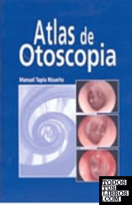 Atlas de otoscopía