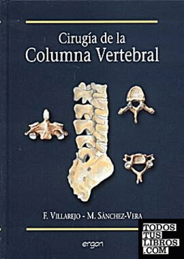 Cirugía de la columna vertebral