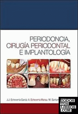 Periodoncia, cirugía periodontal e implantología