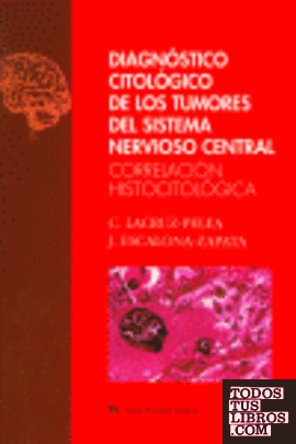 Diagnóstico citológico de los tumores del sistema nervioso central