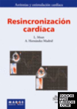 Resincronización cardíaca